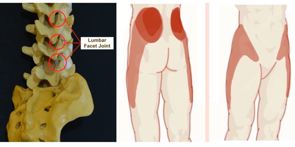 Relief from Back Pain: Top Pain Doctor Now in Kuching 3 2