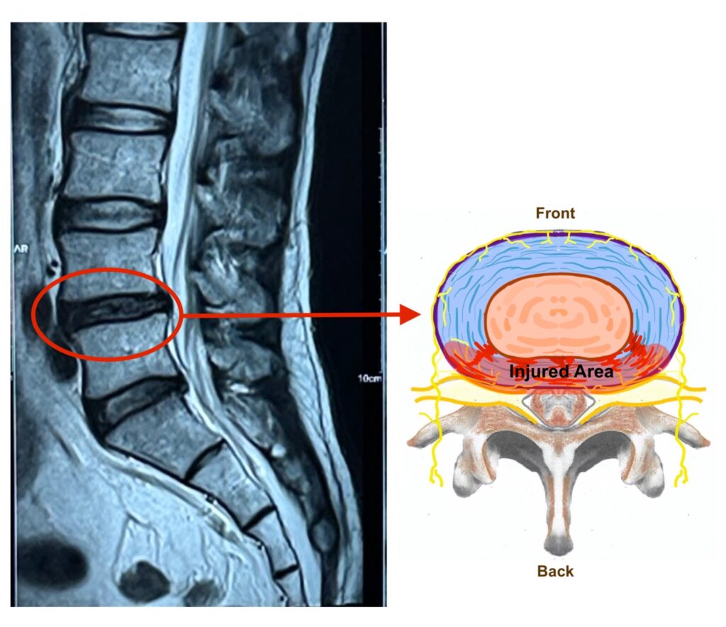 Relief from Back Pain: Top Pain Doctor Now in Kuching 4 3