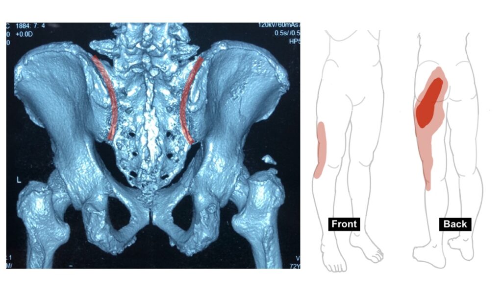 Relief from Back Pain: Top Pain Doctor Now in Kuching 7 6