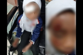 Melaka Girl Badly Hurt in Hit-and-Run Near Bukit Katil School