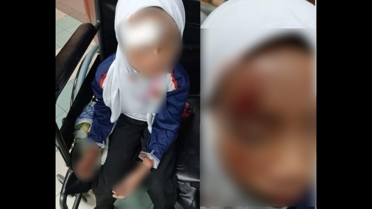 Melaka Girl Badly Hurt in Hit-and-Run Near Bukit Katil School