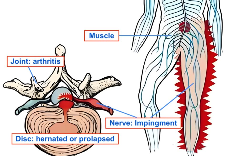 Why Interventional Pain Management is Key for Chronic Pain Relief