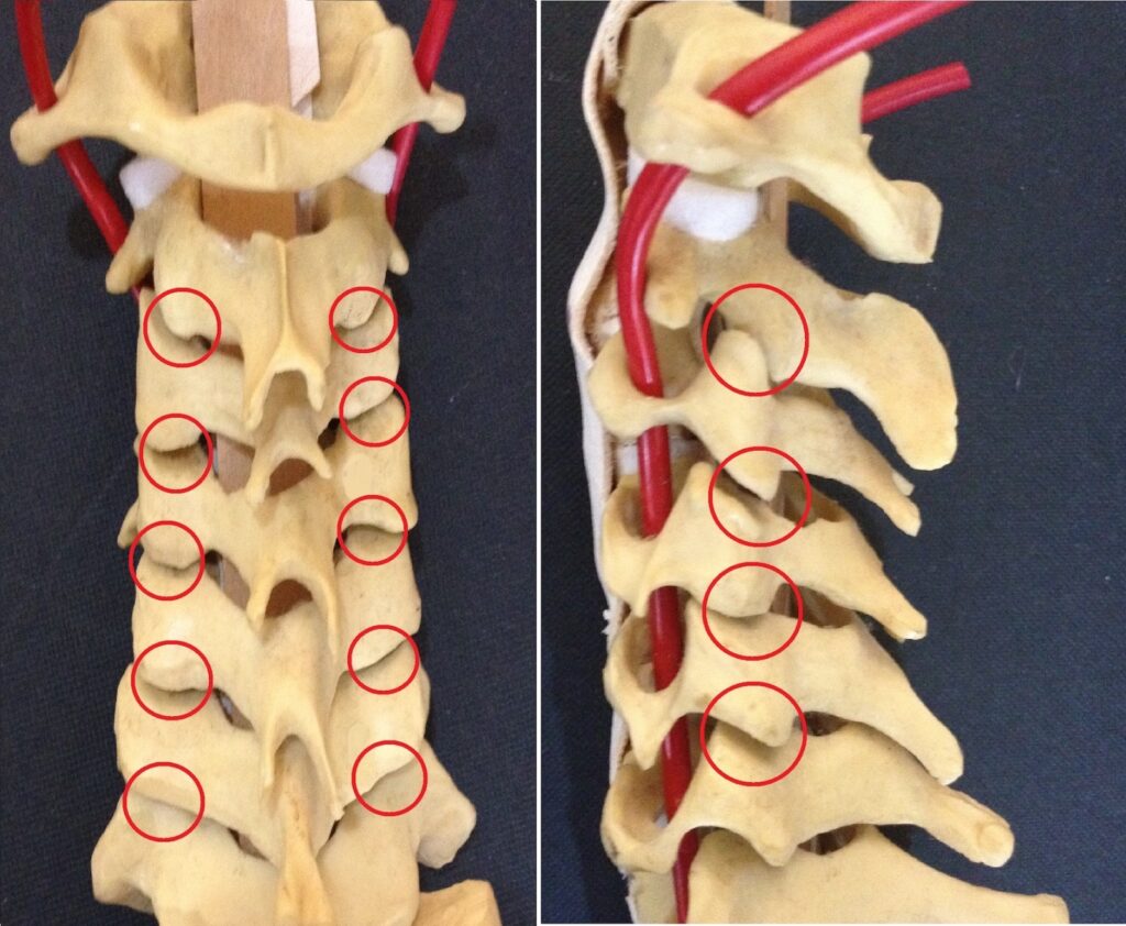 Cervical Facet Joint Pain: A Growing Health Concern Among Malaysians 2 Cervical Facet Joint Pain: A Growing Health Concern Among Malaysians