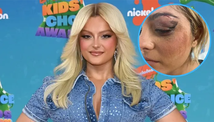 Bebe Rexha Struck by Flying Phone on Face at New York Concert 1 Bebe Rexha Struck by Flying Phone on Face at New York Concert