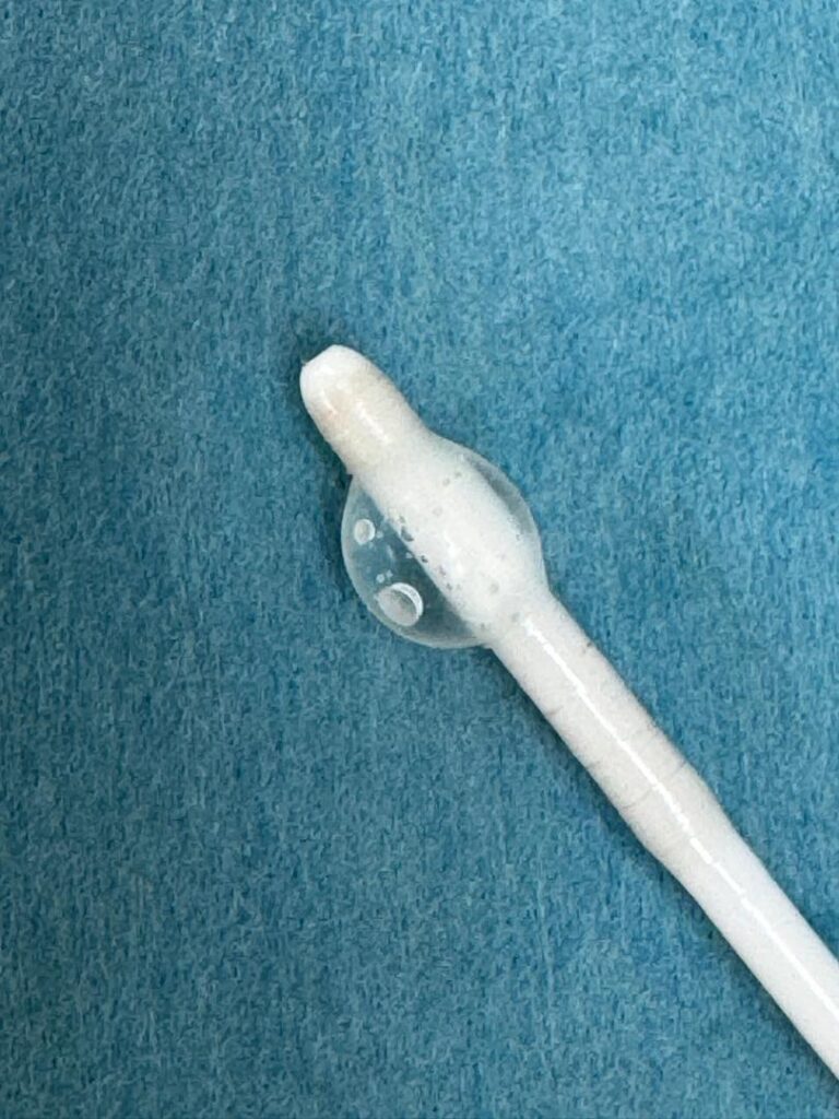 Breakthrough Spine Treatment Now Available at KPJ Kuching