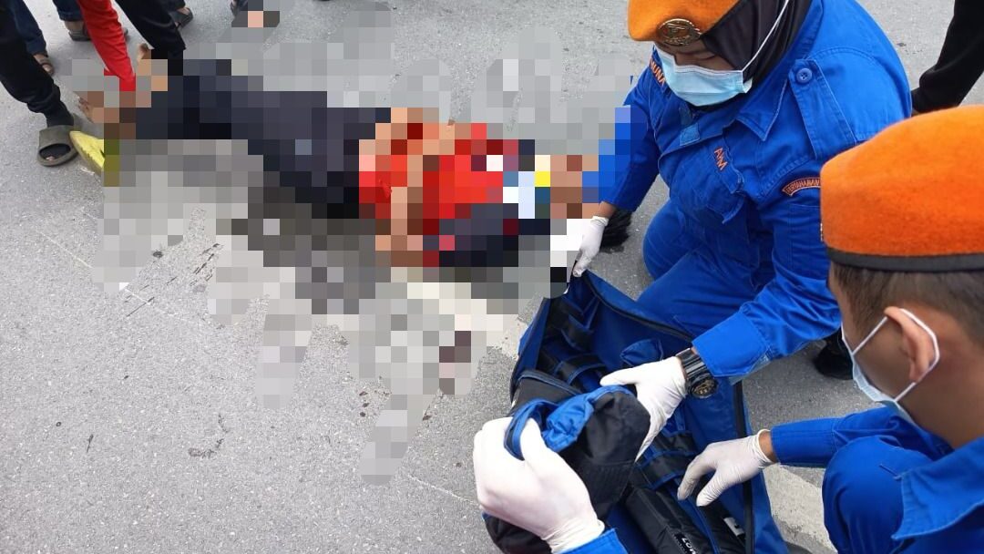 Teenager Injured in Limbang Accident, APM Responds Swiftly 1 Teenager Injured in Limbang Accident, APM Responds Swiftly