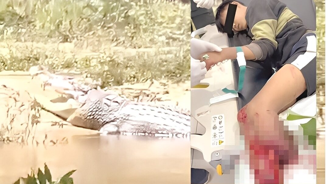 Teen Loses Leg in Crocodile Attack at Kimanis River, Authorities Urged to Act