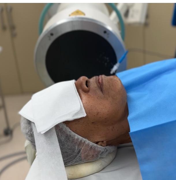Understanding Trigeminal Neuralgia Dr Chen Chee Kean Explains the ‘Electric Shock’ Face Pain
